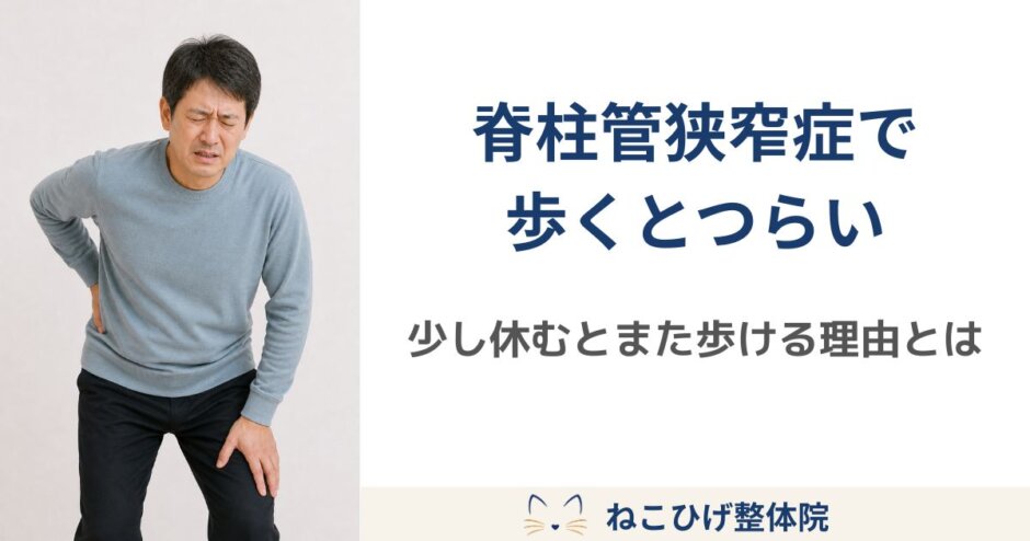 脊柱管狭窄症のような症状で、歩いている途中に腰や足のつらさを感じる中年男性のイメージ画像。