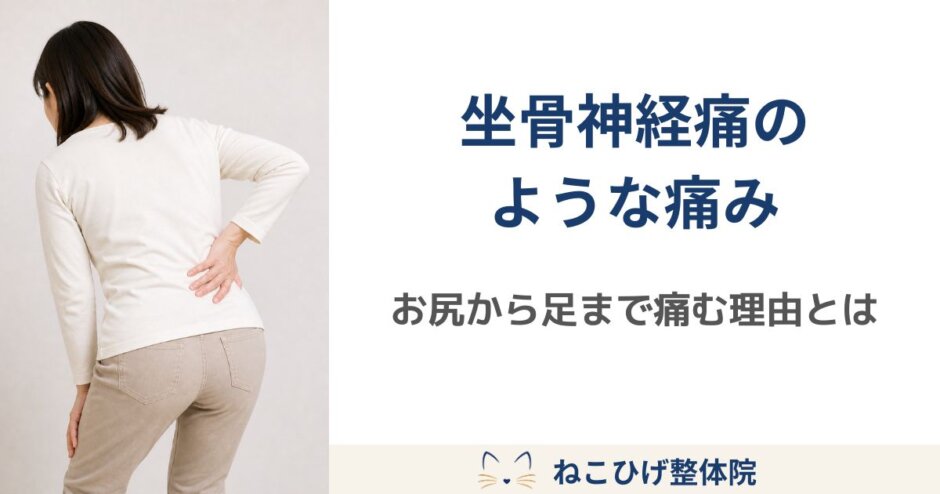 坐骨神経痛のような症状で、お尻から太ももにかけて痛みを感じる中年女性のイメージ画像。